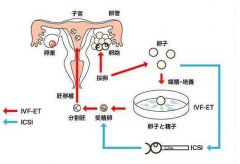 胚胎移植那些事兒！