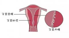 子宫内膜薄？如何治疗