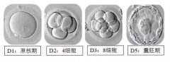 孕期叶酸别乱吃！吃多了会得高血压……