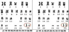 夫妻染色体正常，为什么胚胎染色体异常？