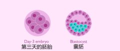 试管婴儿囊胚养成移植到子宫之后，几天可以着