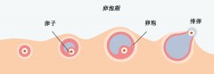 为啥别人的卵泡又大又圆，我的却奇形怪状？